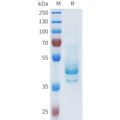 sp-pme101630 cdh1 sp1