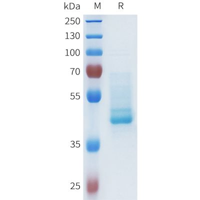 sp-pme101631 cdh1 sp1