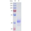 sp-pme101692 5t4 sp1