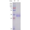 sp-pme101710 acvr2b sp1