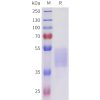 sp-pme101711 acvr2b sp1