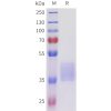 sp-pme101712 acvr2b sp1