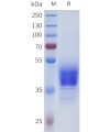 sp-pme101713 par1 sp1