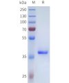 sp-pme101715 tgfb3 sp1