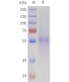 sp-pme101718 nptx2 sp1