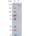 sp-pme101719 lrp6 sp1