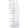 sp-pme101731 sortase a sp1