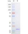sp-pme101731 sortase a sp1