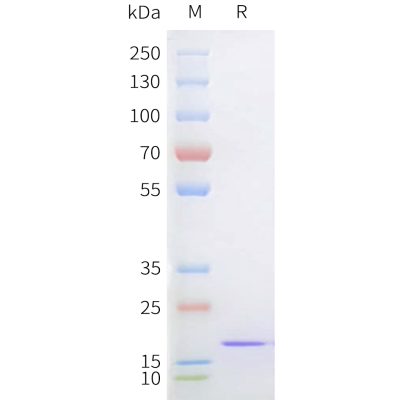 sp-pme101731 sortase a sp1