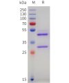 sp-pme101746 vegfc sp1