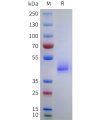 sp-pme101751 anxa2 sp1
