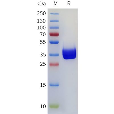 sp-pme101771 cd117 sp1