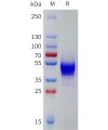 sp-pme101787 kiss1r sp1