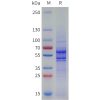 sp-pme101794 vegfb sp1
