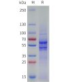 sp-pme101794 vegfb sp1