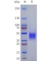 sp-pme101799 adra1a sp1