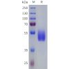 sp-pme101815 vipr2 sp1