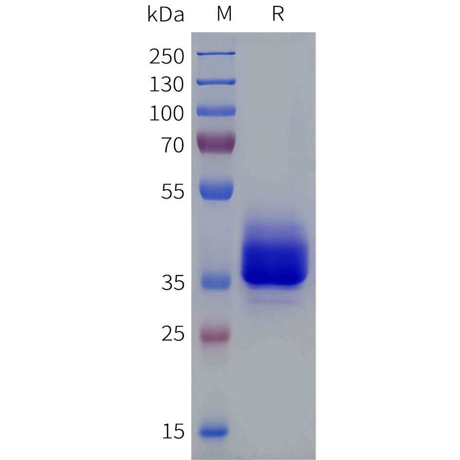 pme101857-lpar3-sp1.png