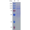 sp-pme101862 slitrk6 sp1