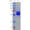 sp-pme101863 epo sp1