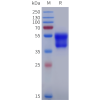 sp-pme101886 adra2a sp1