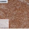 ihc-sli100005 a431 ihc1