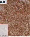 ihc-sli100005 a431 ihc1