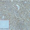 ihc-sli100008 daudi ihc1
