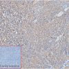 ihc-sli100013 raji ihc1