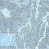 ihc-sli100015 lncap ihc1
