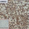 ihc-sli100022 sk br 3 ihc1